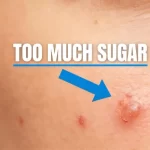 Too Much Sugar? 10 Warning Signs That Are Damaging Your Health